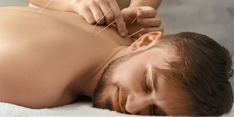 akupunktura w leczeniu bezsenności